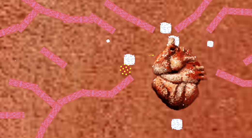 Pathogenesis by Siqi