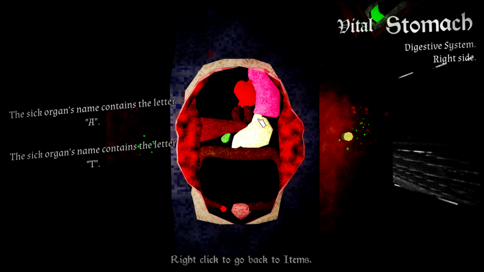Screenshot 5 for Organ Failure