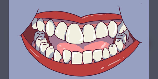 Cover image for Crooked Teeth - GGJ 2024 (GGJ24)