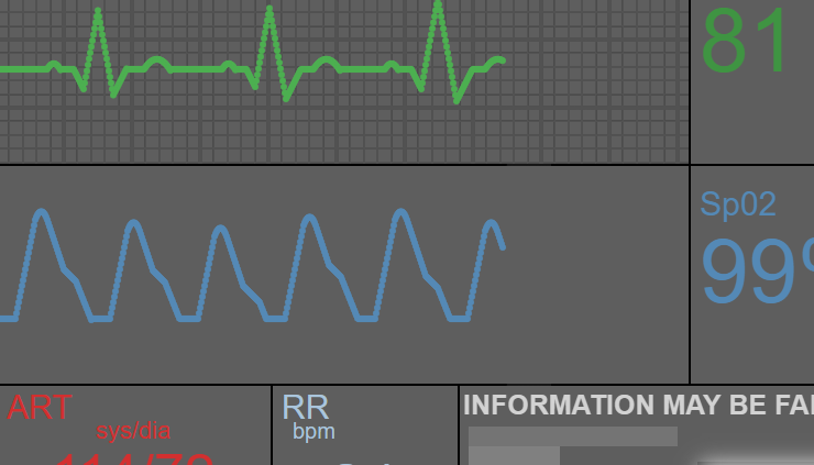 Physiological Monitor Simulator