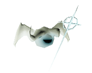 Kill Angle