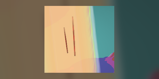 Cover image for [TW self-harm] Rubbing them again
