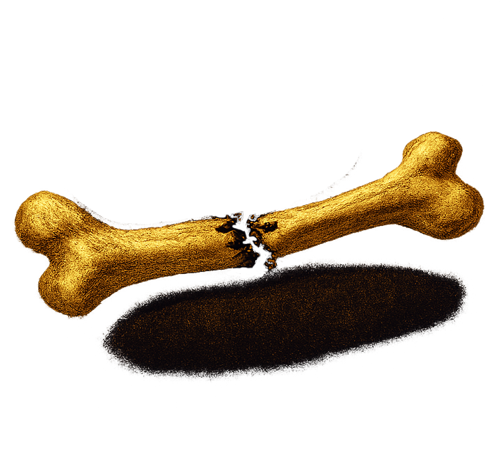 BoneBreaker