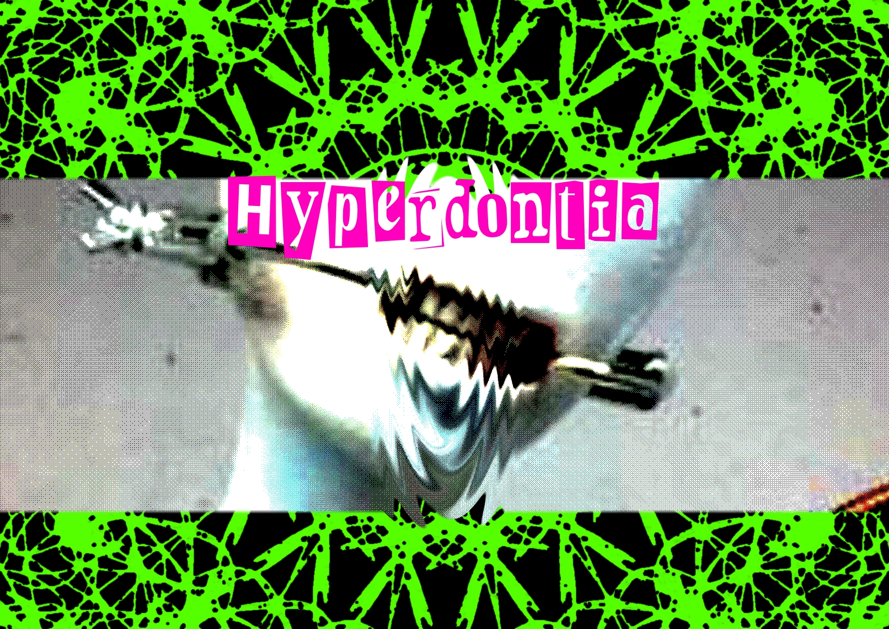 Cover image for Hyperdontia