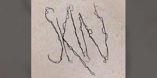 Cover image for SKIN