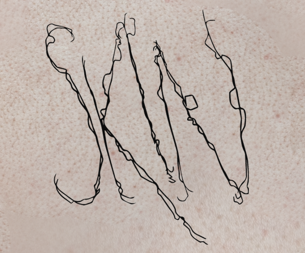 Cover image for SKIN