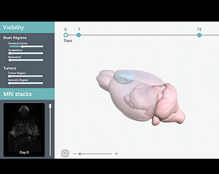 Tumor Pseudoprogression [Free]