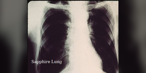 Cover image for Sapphire Lung