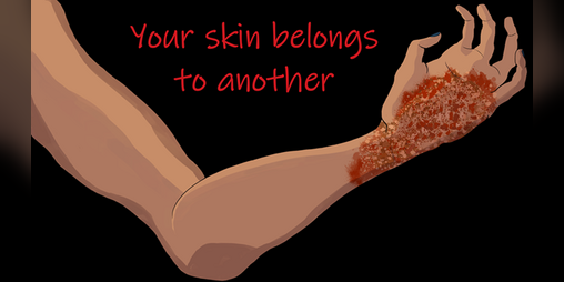 Cover image for Your skin belongs to another
