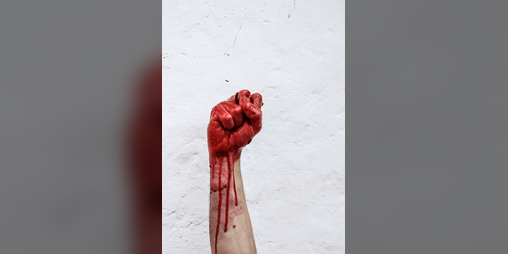 Cover image for afab? more like BEEN STABBED