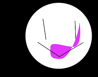 Stickiller