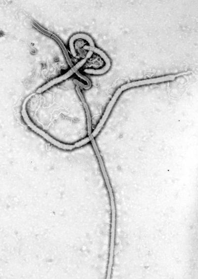 Electron microscope image of an ebola virus