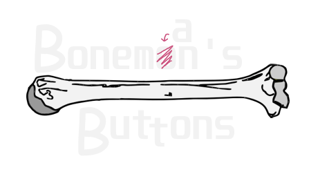 Boneman's Buttons