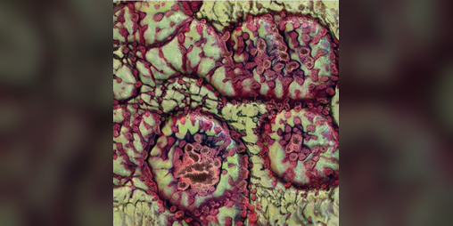 Cover image for Cytotoxicity, Errant Stigma, Dispersal Method Resulting in Necrosis of Host