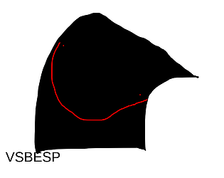 vs besp