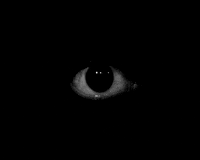 Agoraphobia