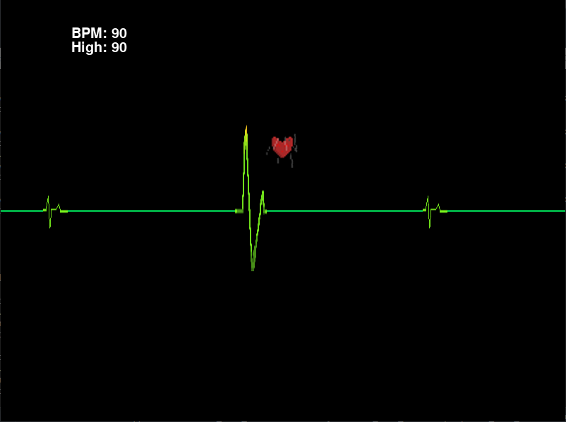 Vitals