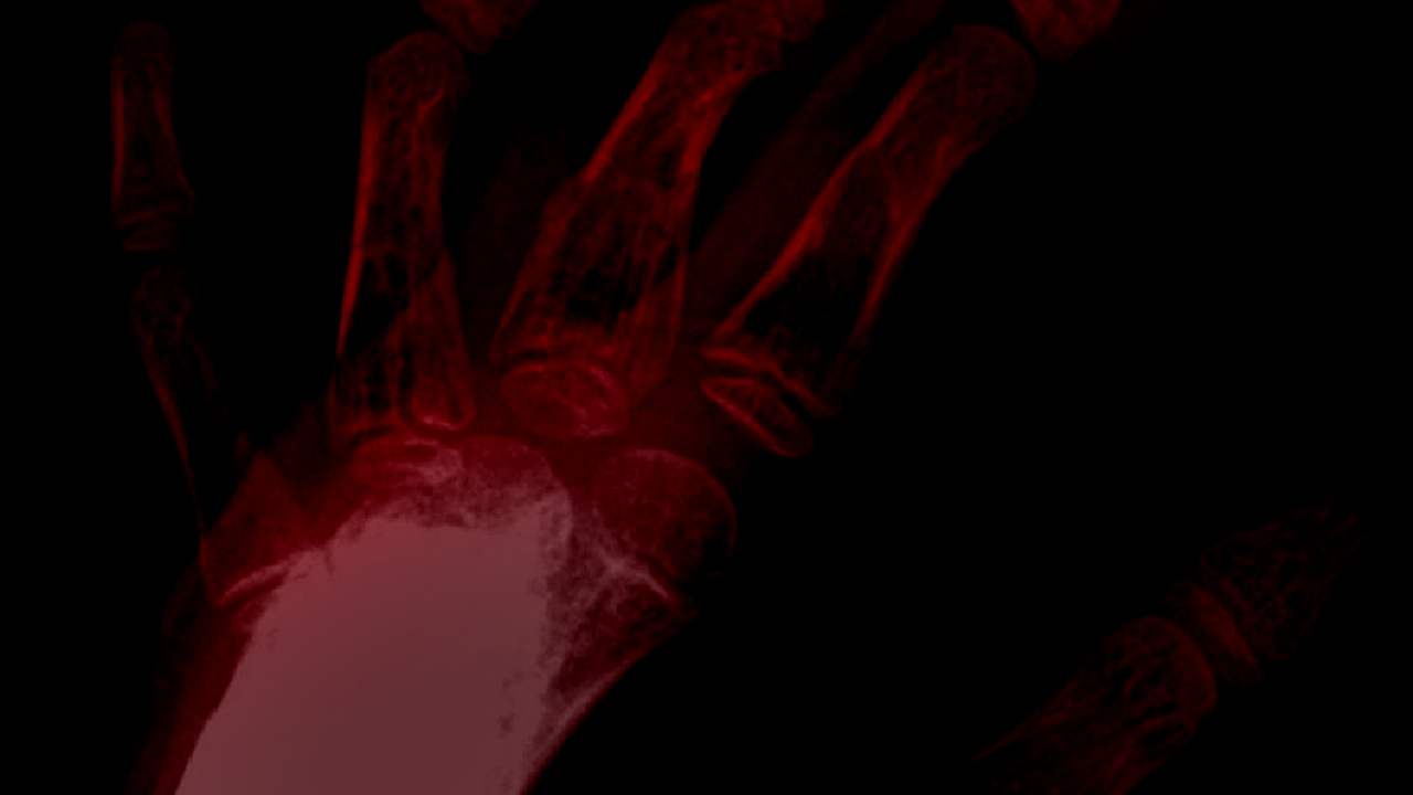Cover image for Necrosis of the Passing Sun