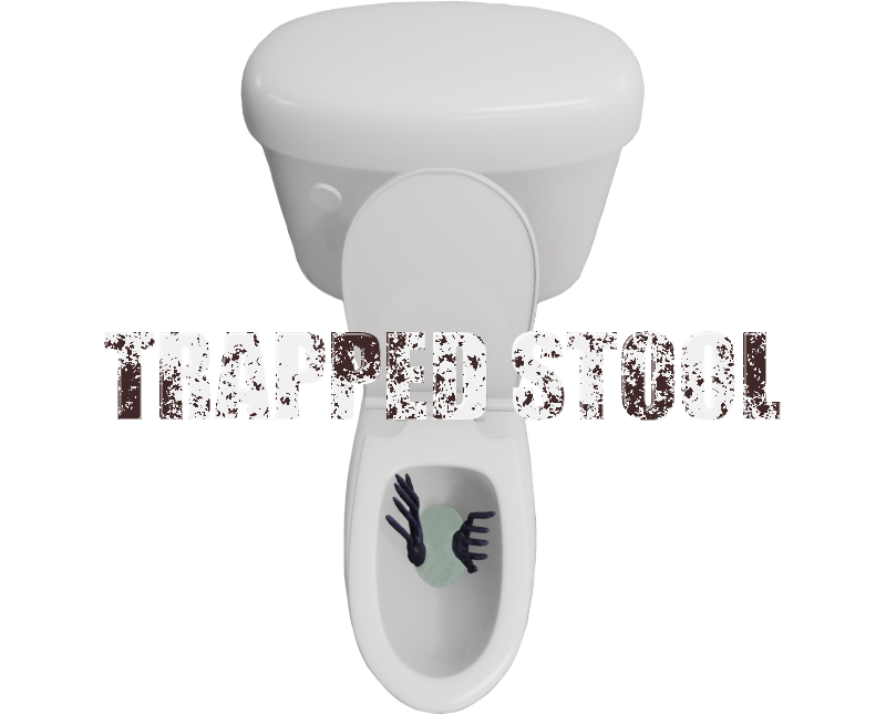 Trapped Stool